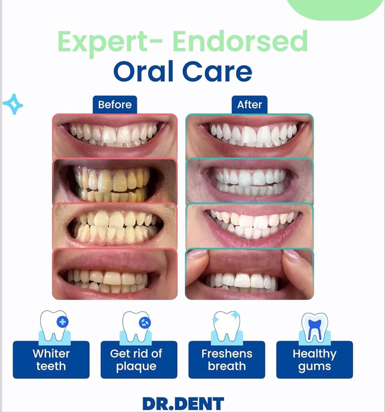 Radiant Whitening &amp; Ultra-Effective Care for Sensitive Teeth