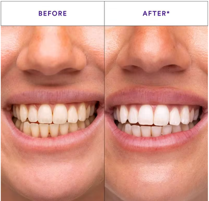 Radiant Whitening &amp; Ultra-Effective Care for Sensitive Teeth